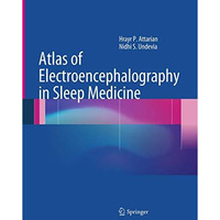 Atlas of Electroencephalography in Sleep Medicine [Paperback]