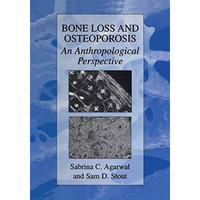 Bone Loss and Osteoporosis: An Anthropological Perspective [Hardcover]