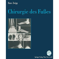 Chirurgie des Fu?es [Paperback]