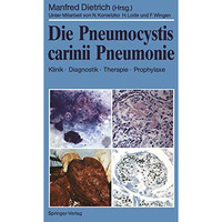 Die Pneumocystis carinii Pneumonie: Klinik ? Diagnostik ? Therapie ? Prophylaxe [Paperback]