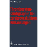 Thrombozytenszintigraphie bei zerebrovaskul?ren Erkrankungen: Methodik ? Ergebni [Paperback]