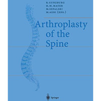 Arthroplasty of the Spine [Paperback]