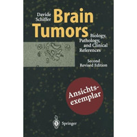 Brain Tumors: Biology, Pathology and Clinical References [Paperback]