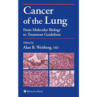 Cancer of the Lung: From Molecular Biology to Treatment Guidelines [Hardcover]