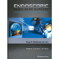 Endoscopic Skull Base Surgery: A Comprehensive Guide with Illustrative Cases [Paperback]