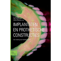 Implantaten en prothetische constructies: Een inleiding voor mondhygi?nisten [Paperback]