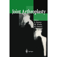 Joint Arthroplasty [Hardcover]