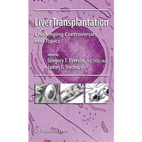 Liver Transplantation: Challenging Controversies and Topics [Hardcover]