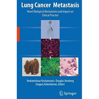 Lung Cancer Metastasis: Novel Biological Mechanisms and Impact on Clinical Pract [Hardcover]