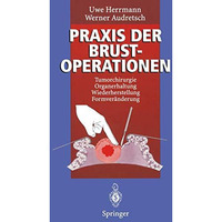 Praxis der Brustoperationen: Tumorchirurgie  Organerhaltung  Wiederherstellung [Paperback]