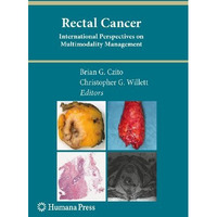 Rectal Cancer: International Perspectives on Multimodality Management [Hardcover]