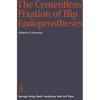 The Cementless Fixation of Hip Endoprostheses [Paperback]