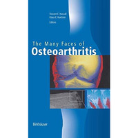 The Many Faces of Osteoarthritis [Hardcover]