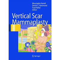 Vertical Scar Mammaplasty [Paperback]