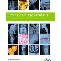 Atlas of Osteoarthritis [Paperback]