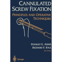 Cannulated Screw Fixation: Principles and Operative Techniques [Paperback]