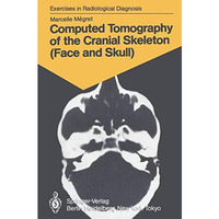 Computed Tomography of the Cranial Skeleton (Face and Skull): 58 Radiological Ex [Paperback]