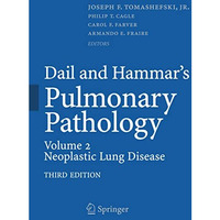 Dail and Hammar's Pulmonary Pathology: Volume II: Neoplastic Lung Disease [Paperback]