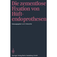 Die zementlose Fixation von H?ftendoprothesen [Paperback]