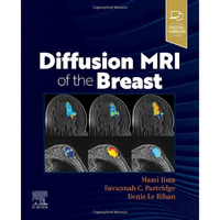 Diffusion MRI of the Breast [Paperback]