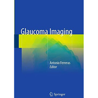 Glaucoma Imaging [Paperback]