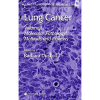 Lung Cancer: Volume 1: Molecular Pathology Methods and Reviews [Hardcover]