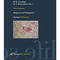 Prion Diseases: Diagnosis and Pathogenesis [Paperback]