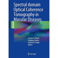 Spectral Domain Optical Coherence Tomography in Macular Diseases [Hardcover]