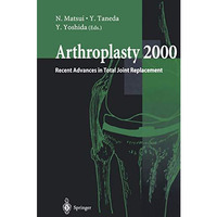 Arthroplasty 2000: Recent Advances in Total Joint Replacement [Paperback]