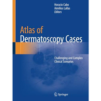 Atlas of Dermatoscopy Cases: Challenging and Complex Clinical Scenarios [Paperback]