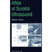 Atlas of Scrotal Ultrasound [Paperback]