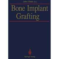 Bone Implant Grafting [Paperback]