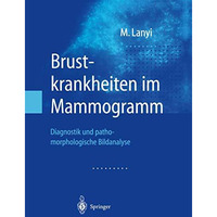 Brustkrankheiten im Mammogramm: Diagnostik und pathomorphologische Bildanalyse [Paperback]