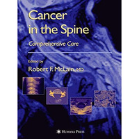 Cancer in the Spine: Comprehensive Care [Hardcover]