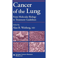 Cancer of the Lung: From Molecular Biology to Treatment Guidelines [Paperback]