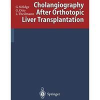 Cholangiography After Orthotopic Liver Transplantation [Paperback]