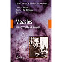 Measles: History and Basic Biology [Hardcover]