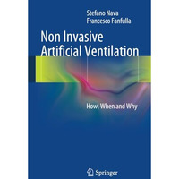 Non Invasive Artificial Ventilation: How, When and Why [Paperback]