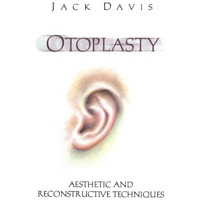 Otoplasty: Aesthetic and Reconstructive Techniques [Paperback]