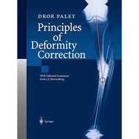 Principles of Deformity Correction [Paperback]