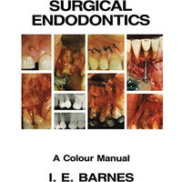 Surgical Endodontics: A Colour Manual [Paperback]