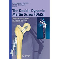 The Double Dynamic Martin Screw (DMS): Adjustable Implant System for Proximal an [Paperback]