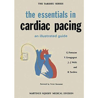 the essentials in cardiac pacing: An Illustrated Guide [Paperback]