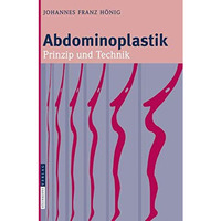 Abdominoplastik: Prinzip und Technik [Hardcover]