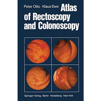 Atlas of Rectoscopy and Coloscopy [Paperback]