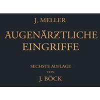 Augen?rztliche Eingriffe: Eine Kurzgefasste Operationslehre [Paperback]