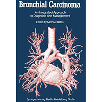 Bronchial Carcinoma: An Integrated Approach to Diagnosis and Management [Paperback]