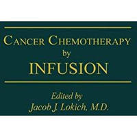 Cancer Chemotherapy by Infusion [Paperback]