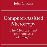 Computer-Assisted Microscopy: The Measurement and Analysis of Images [Paperback]