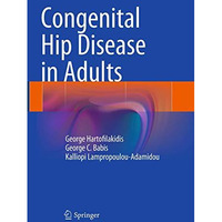 Congenital Hip Disease in Adults [Paperback]